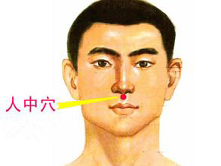 水溝穴→治昏迷、暈厥