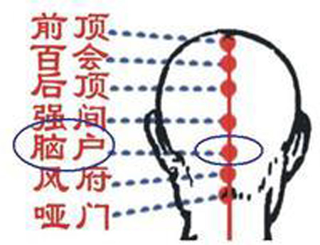 腦戶穴→治頭重、頭痛