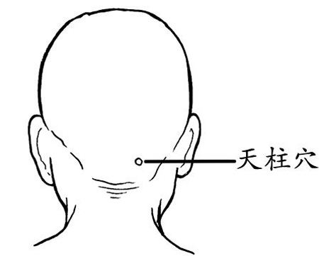 天柱穴→治頭痛、項(xiàng)強(qiáng)