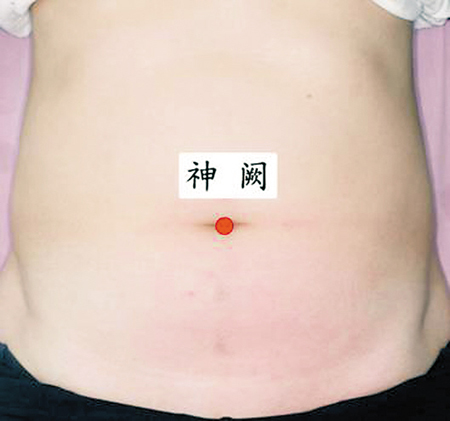 神闕穴→治腸炎、痢疾