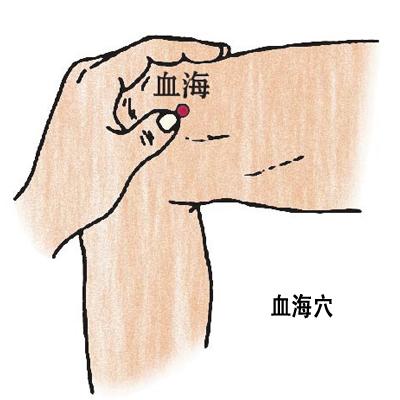 血海穴→治濕疹、丹毒