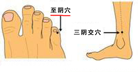至陰穴→治頭痛、目痛