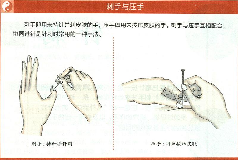 一般針?lè)ǖ倪\(yùn)用原則是什么？