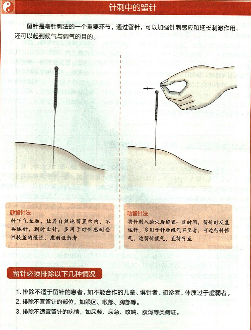 針刺穴位時有哪些需要注意的？