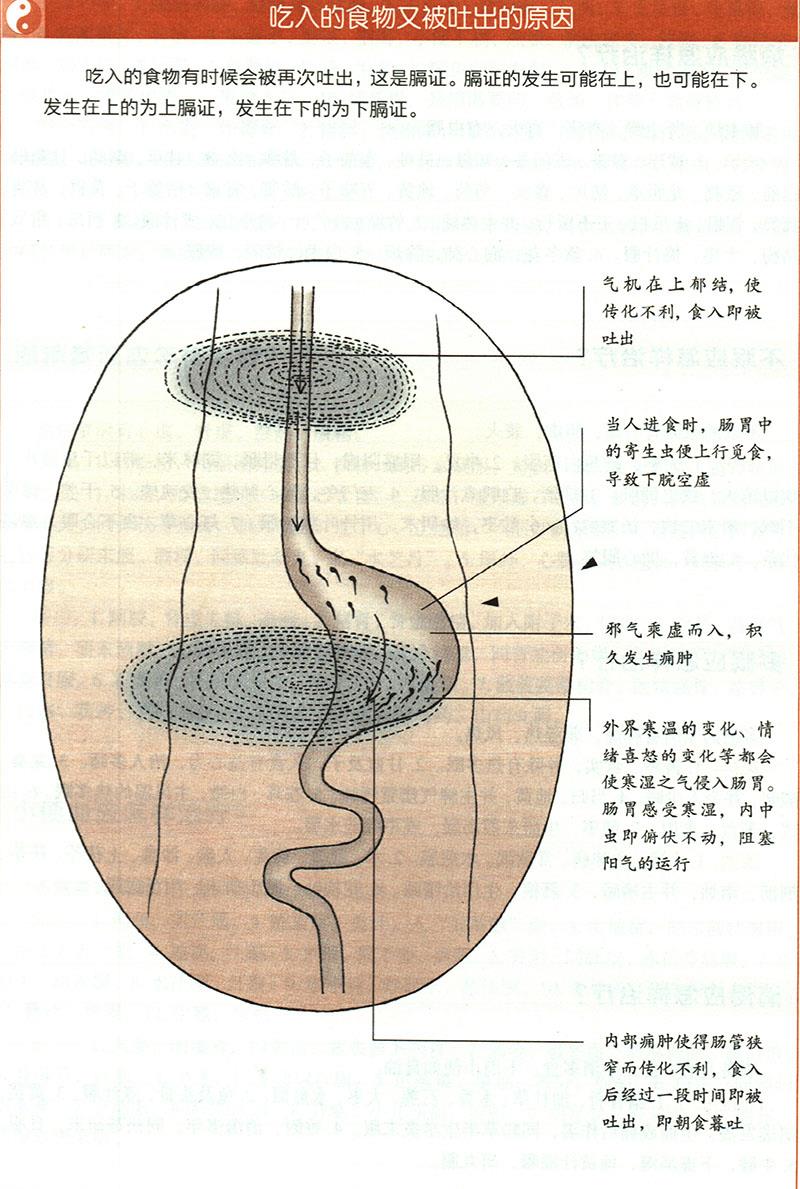 嘔吐應(yīng)怎樣治療？
