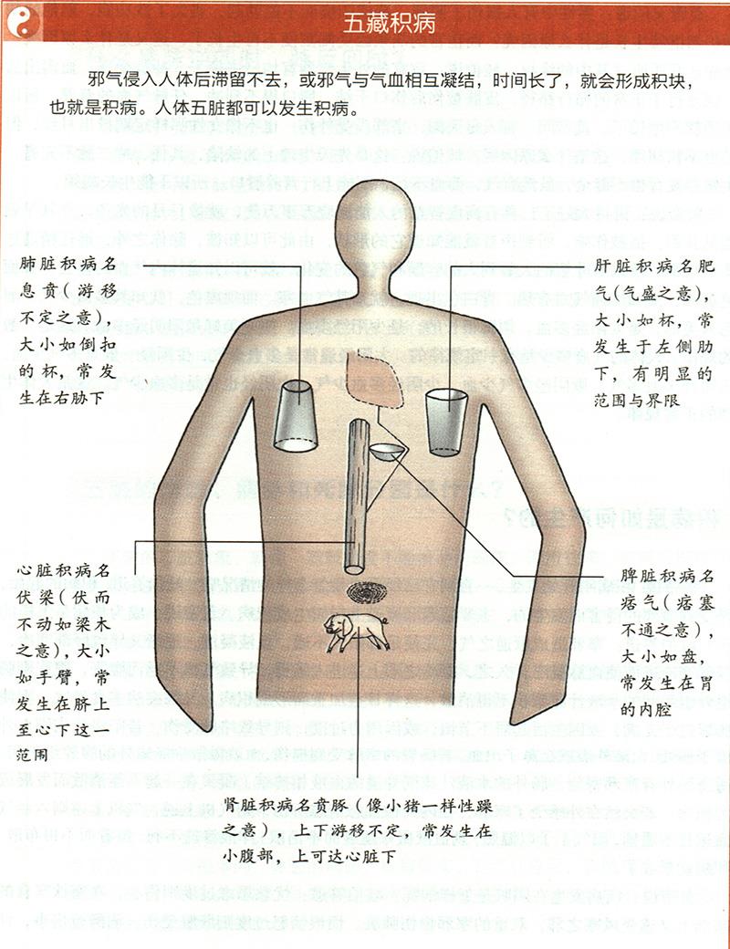 積病是如何產生的？
