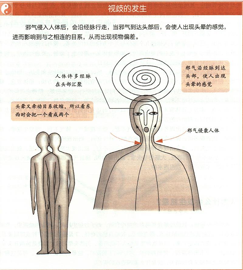 人為什么會發(fā)生眩暈？